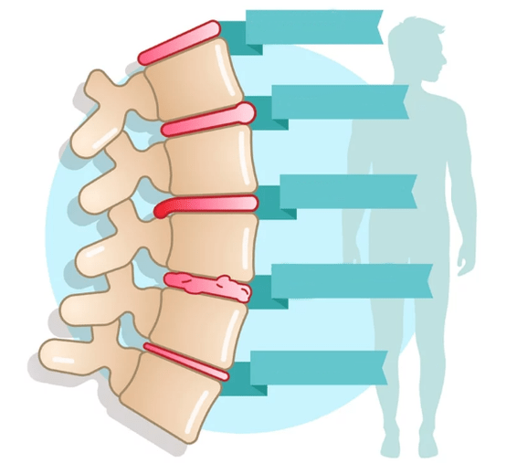 Grau de doença da osteocondrose torácica