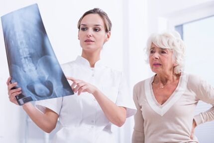 O médico mostra ao paciente uma imagem de raios X da coluna