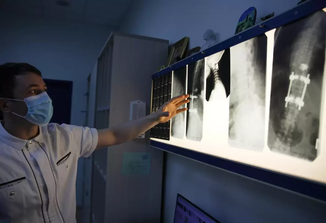 Os médicos diagnosticam a osteocondrose cervical usando métodos instrumentais, como radiografia